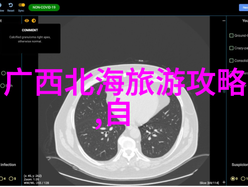 欧洲浪漫之旅巴黎罗马威尼斯